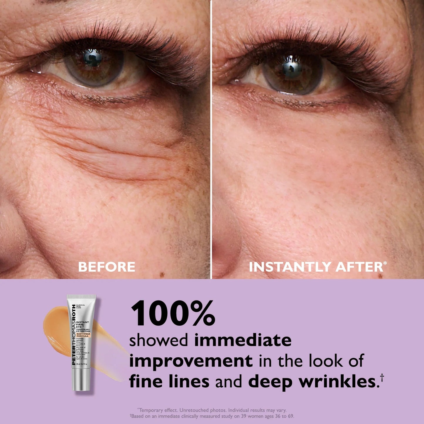 Peter Thomas Roth | Instant FIRMx® Eye Temporary Eye Tightener Easy-Wear Formula