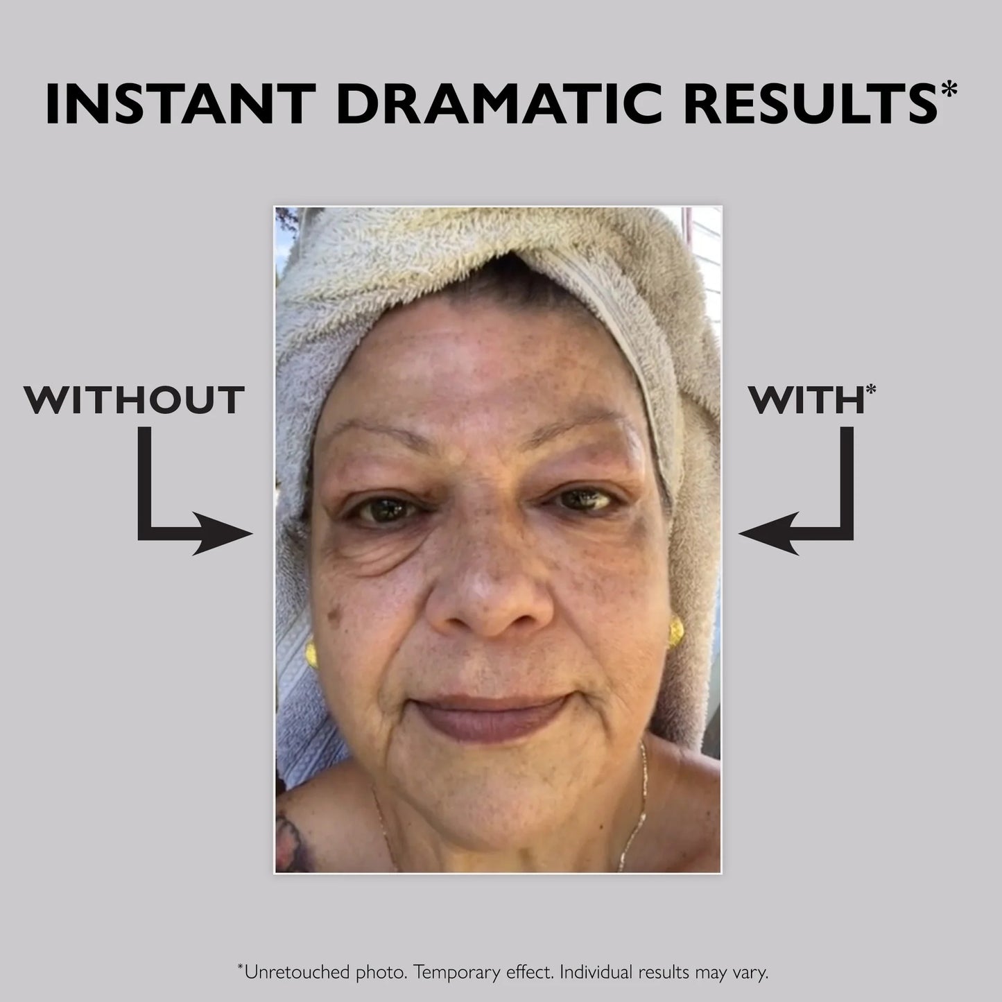 Peter Thomas Roth | Instant FIRMx® Temporary Eye Tightener | Firm and Smooth the Look of Fine Lines
