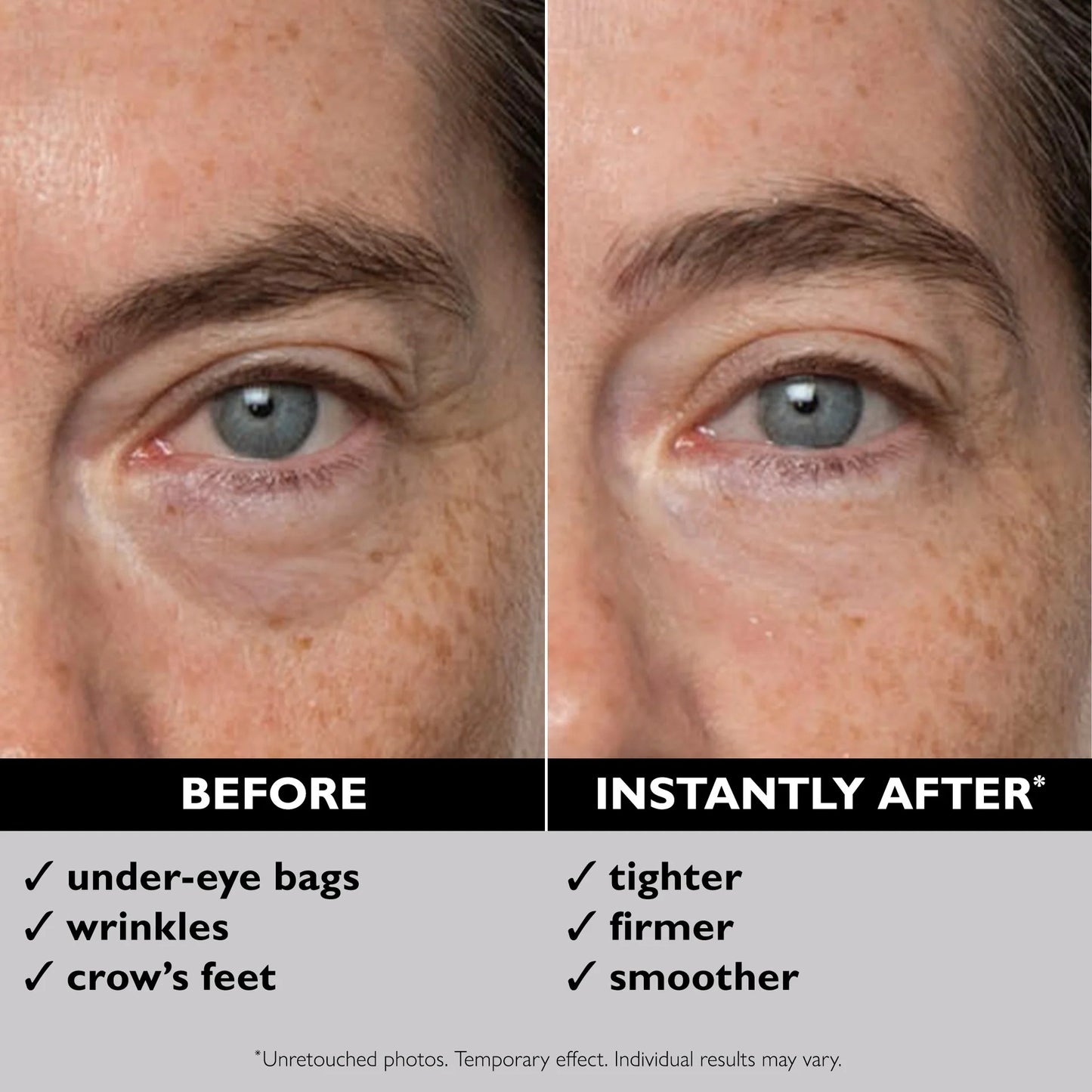 Peter Thomas Roth | Instant FIRMx® Temporary Eye Tightener | Firm and Smooth the Look of Fine Lines